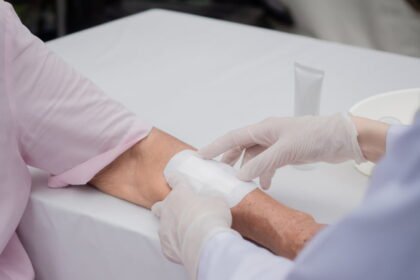 Wound Healing