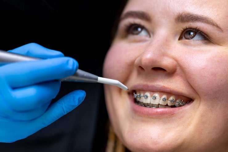 Preventing Future Dental Issues