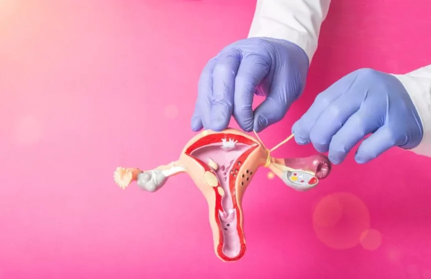 Tubal Reversal